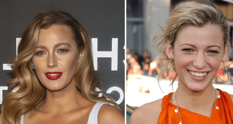 Latest News Blake Lively Before and After